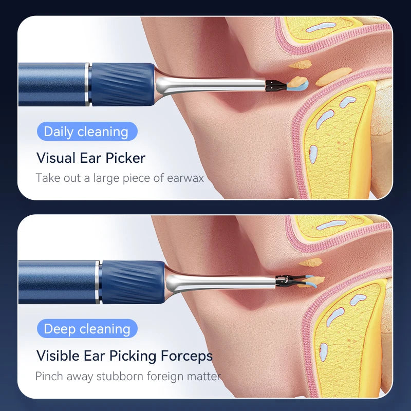 Ear care Wax Removal Tool